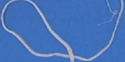 Canine-tapeworm